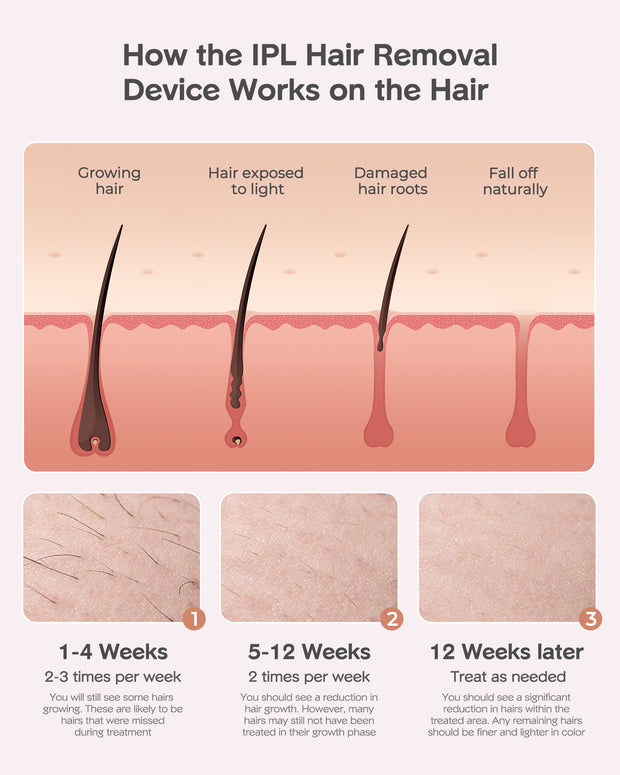INNZA Laser Hair Removal, IPL Painless Permanent Hair Removal, Facial Hair Remover for Armpits Legs Arms Bikini Line, Pink